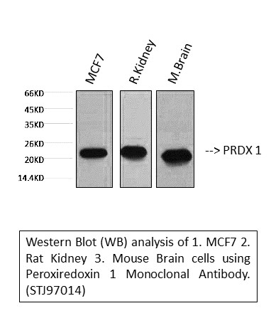 Western blotting validation for Anti-Peroxiredoxin 1 PRDX1 Monoclonal Antibody M01845-2
Western blot (WB) analysis of Peroxiredoxin 1 monoclonal antibody