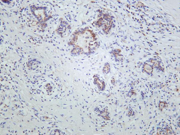 Human thyroid was stained with anti-Peroxiredoxin 1 rabbit antibody