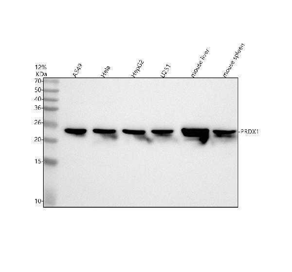  Western blot analysis of PRDX1/Peroxiredoxin 1 using anti-PRDX1/Peroxiredoxin 1 antibody (M01845)