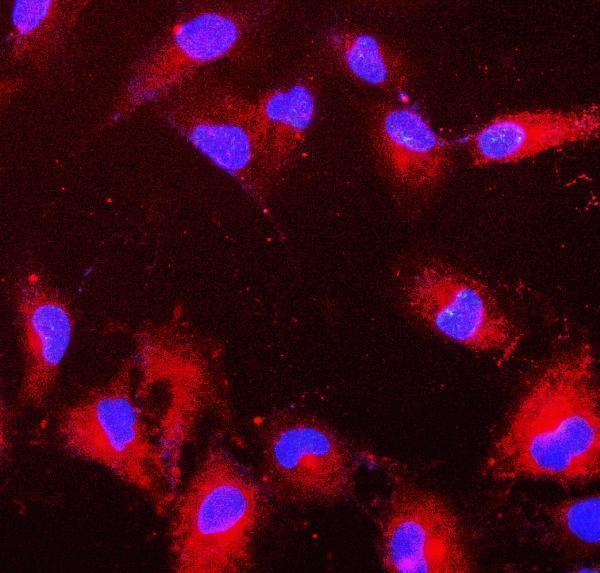 m01847 1 prdx6 primary antibodies if testing 2_1
