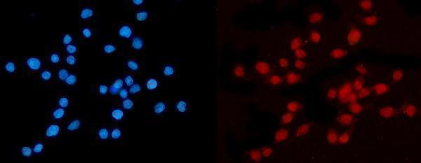 m01851 2 kpnb1 primary antibodies if testing 13