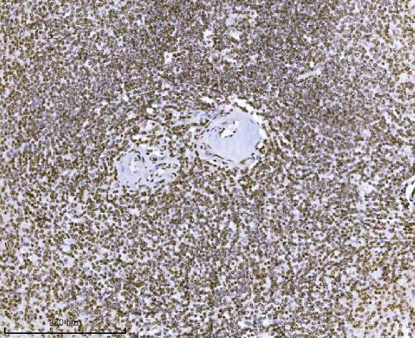 m01851 2 kpnb1 primary antibodies ihc testing 10