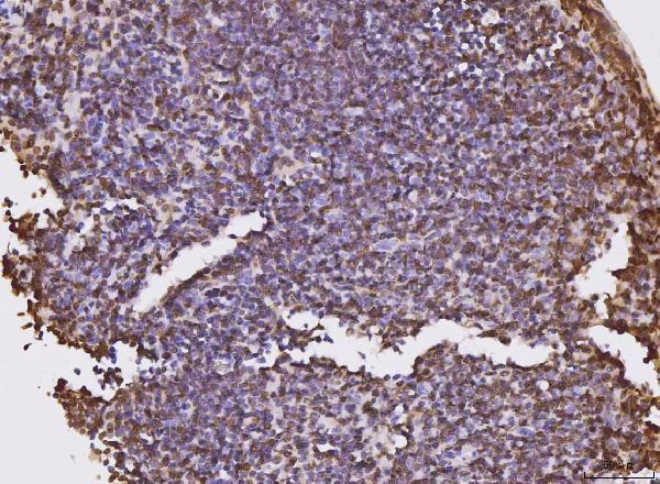 m01851 2 kpnb1 primary antibodies ihc testing 11
