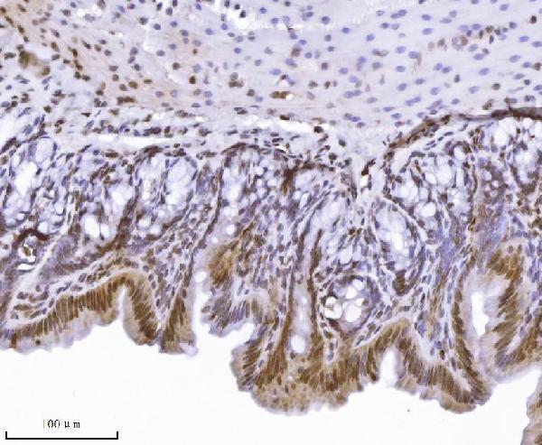 m01851 2 kpnb1 primary antibodies ihc testing 12