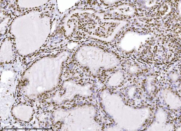  IHC analysis of KPNB1 using anti-KPNB1 antibody (M01851-2)
