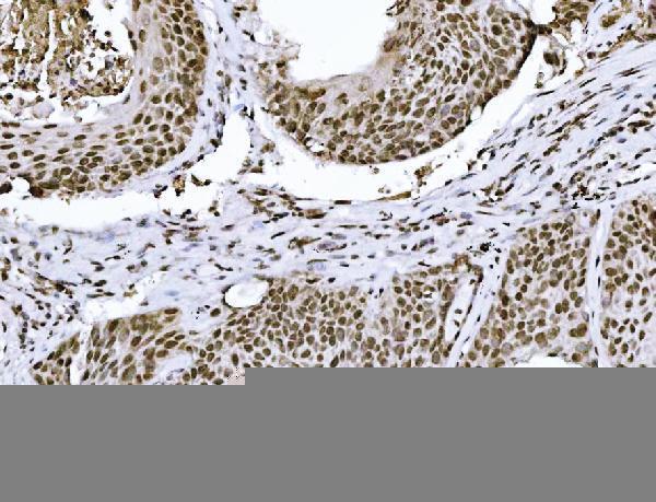  IHC analysis of KPNB1 using anti-KPNB1 antibody (M01851-2)
