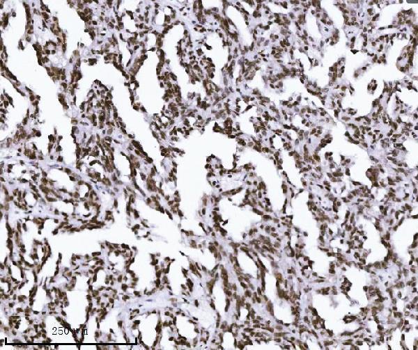 m01851 2 kpnb1 primary antibodies ihc testing 4