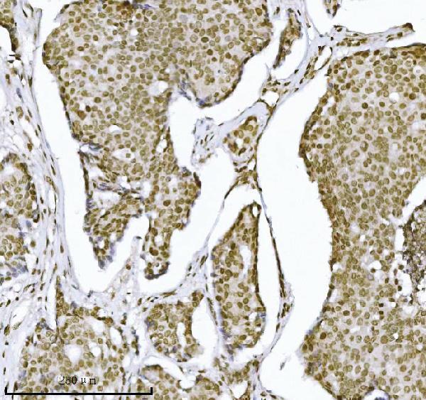 m01851 2 kpnb1 primary antibodies ihc testing 5