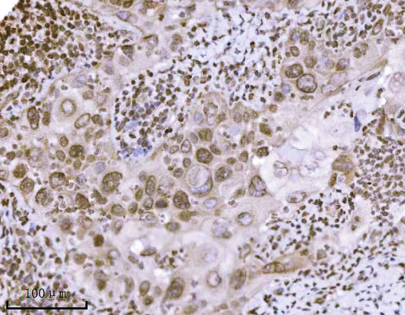 m01851 2 kpnb1 primary antibodies ihc testing 7