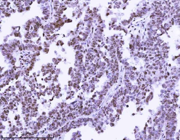 m01851 2 kpnb1 primary antibodies ihc testing 8