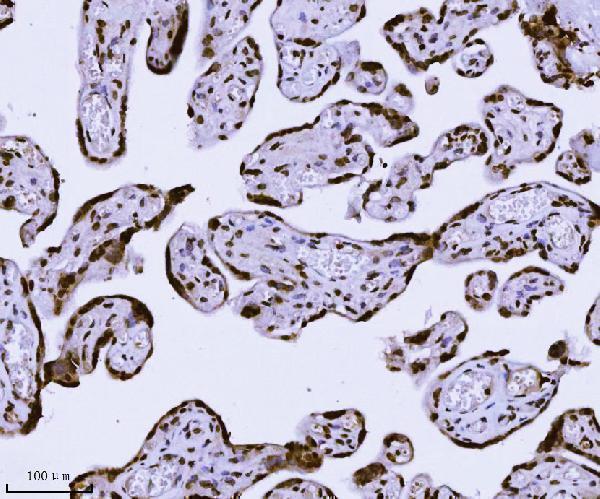 m01851 2 kpnb1 primary antibodies ihc testing 9
