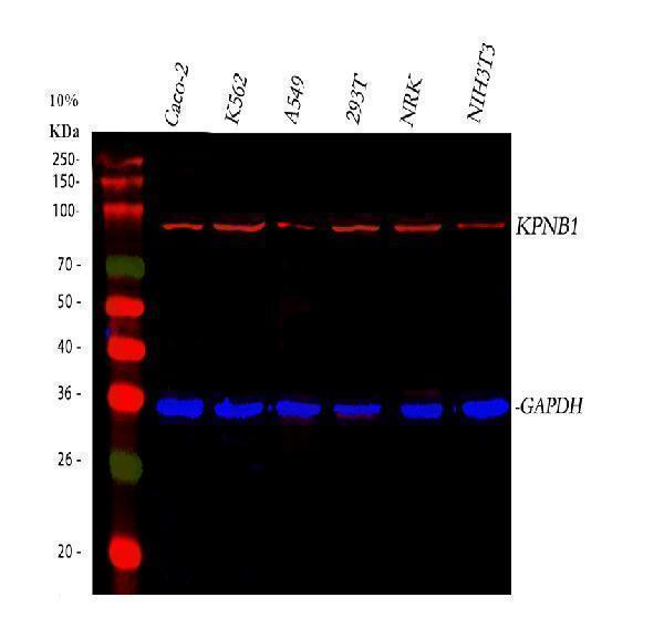  Western blot analysis of KPNB1 using anti-KPNB1 antibody (M01851-2)