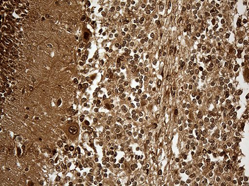 Immunohistochemical staining of paraffin-embedded Human embryonic cerebellum within the normal limits using anti-KPNB1 mouse monoclonal antibody