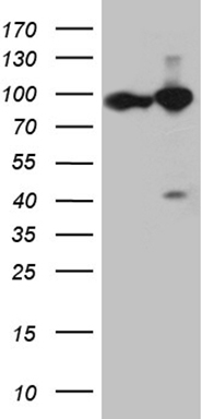 HEK293T cells were transfected with the pCMV6-ENTRY control (Left lane) or pCMV6-ENTRY KPNB1 (Right lane) cDNA for 48 hrs and lysed