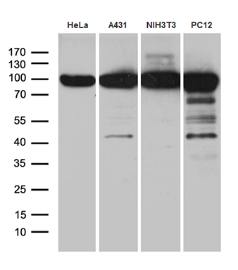 Western blot analysis of extracts (35ug) from 4 different cell lines by using anti-KPNB1 monoclonal antibody (1:500)