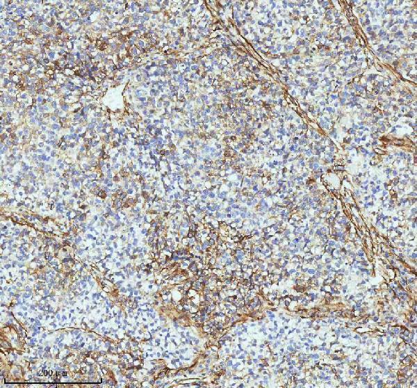 m01857 1 tubb3 primary antibodies ihc testing 10