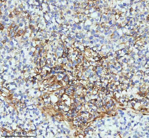 m01857 1 tubb3 primary antibodies ihc testing 11