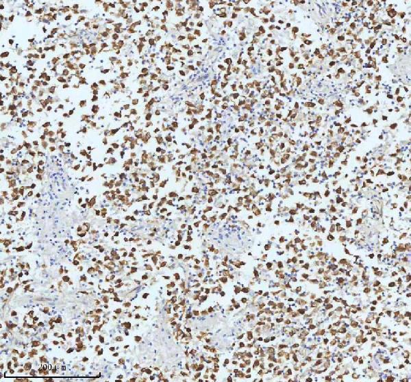 m01857 1 tubb3 primary antibodies ihc testing 2