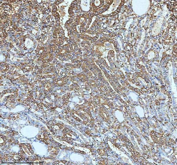 m01857 1 tubb3 primary antibodies ihc testing 4