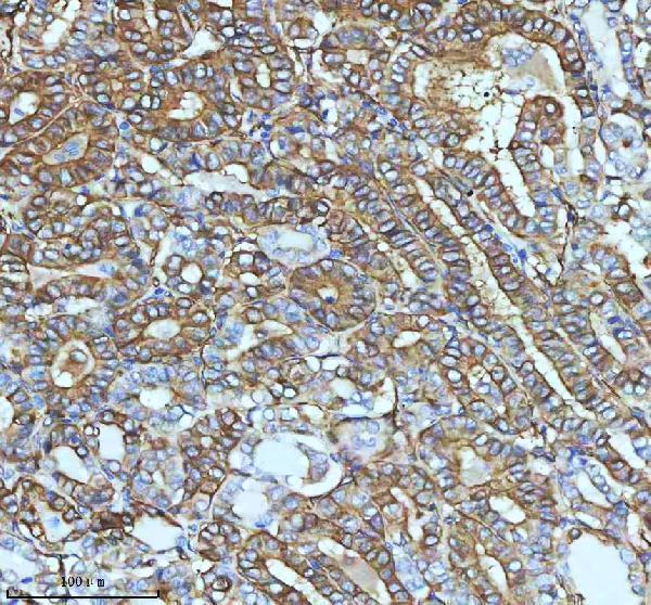 m01857 1 tubb3 primary antibodies ihc testing 5