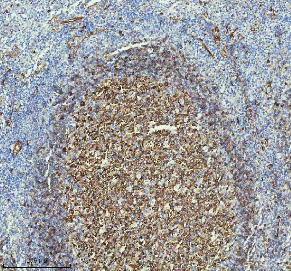 m01857 1 tubb3 primary antibodies ihc testing 6