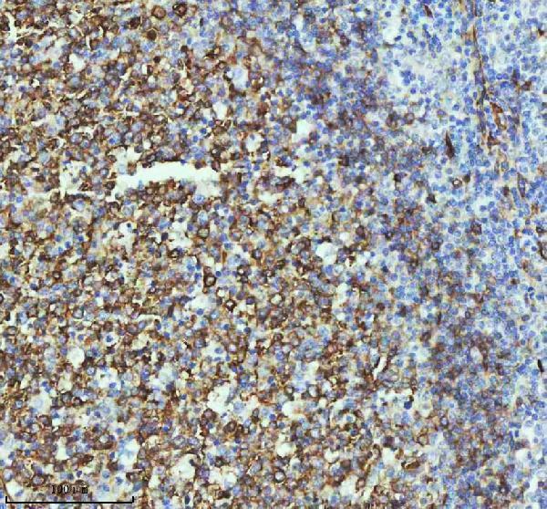m01857 1 tubb3 primary antibodies ihc testing 7