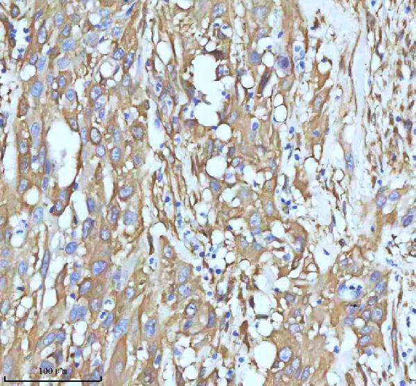 m01857 1 tubb3 primary antibodies ihc testing 9