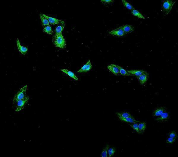 m01857 3 tubulin_beta primary antibodies if testing 2