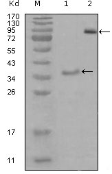 Western Blot analysis using EphA3 Monoclonal Antibody against truncated Trx-EphA3 recombinant protein (1) and truncated EphA3 (aa566-983)-hIgGFc transfected CHO-K1 cell lysate (2)