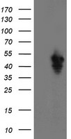 HEK293T cells were transfected with the pCMV6-ENTRY control (Left lane) or pCMV6-ENTRY SERPINE2 (Right lane) cDNA for 48 hrs and lysed