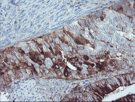 m01863 anti serpine2 mouse monoclonal antibody clone id oti2c9 ihc testing 5
