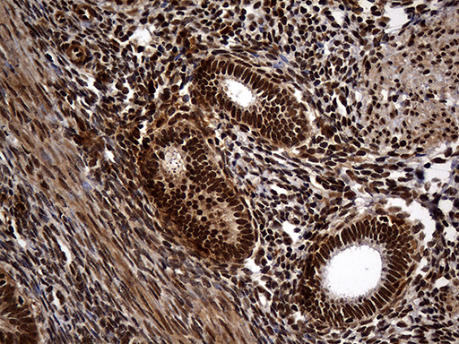 Immunohistochemical staining of paraffin-embedded Human endometrium tissue within the normal limits using anti-RAD21 mouse monoclonal antibody