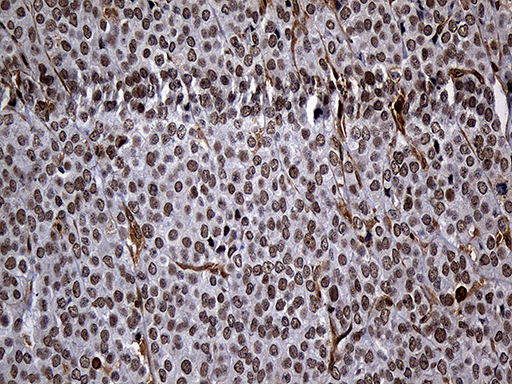 m01864 1 anti rad21 mouse monoclonal antibody clone id oti6c10 ihc testing 5