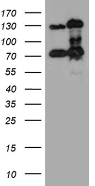HEK293T cells were transfected with the pCMV6-ENTRY control (Left lane) or pCMV6-ENTRY RAD21 (Right lane) cDNA for 48 hrs and lysed