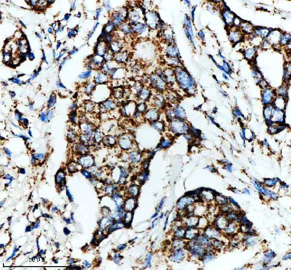 IHC analysis of GLUD1 using anti-GLUD1 antibody (M01866)