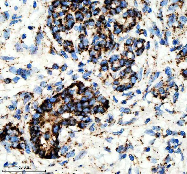 IHC analysis of GLUD1 using anti-GLUD1 antibody (M01866)