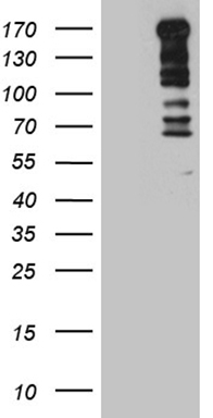 HEK293T cells were transfected with the pCMV6-ENTRY control (Left lane) or pCMV6-ENTRY TOPBP1 (Right lane) cDNA for 48 hrs and lysed