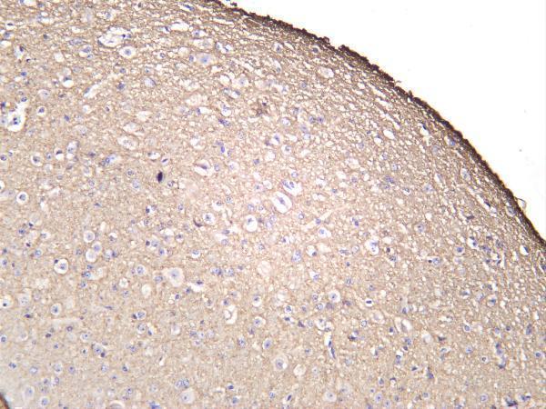 Mouse brain was stained with anti-GAP43 rabbit antibody