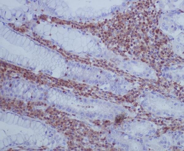 Immunohistochemical analysis of paraffin-embedded human stomach, using GAP43 Antibody