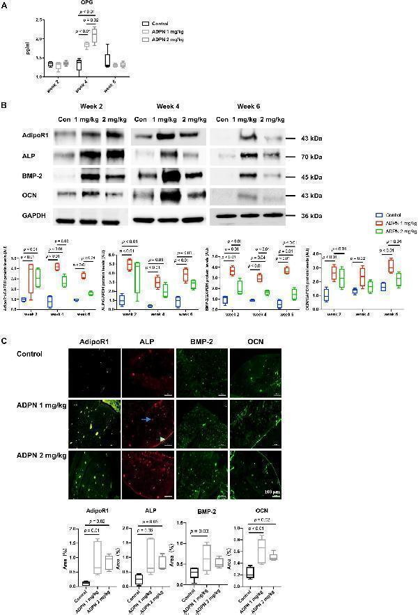 Mechanisms for local medulla injection of ADPN promoting bone healing