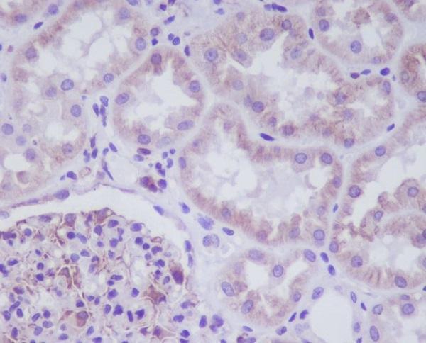 Immunohistochemical analysis of paraffin-embedded human kidney, using ADIPOR1 Antibody