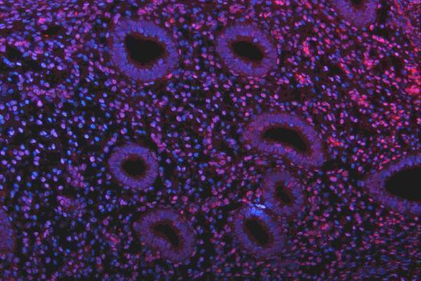 m01874 qk1 primary antibodies if testing 16