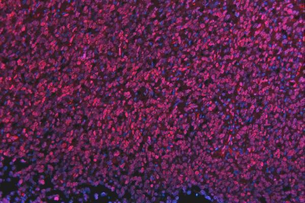 m01874 qk1 primary antibodies if testing 17