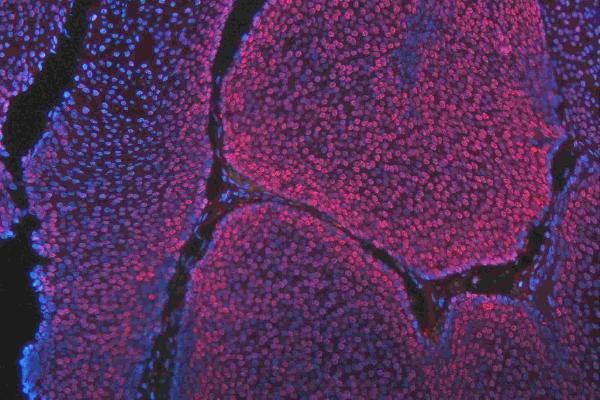 m01874 qk1 primary antibodies if testing 19