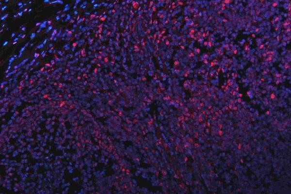 m01874 qk1 primary antibodies if testing 21