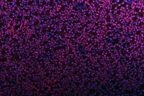 m01874 qk1 primary antibodies if testing 22