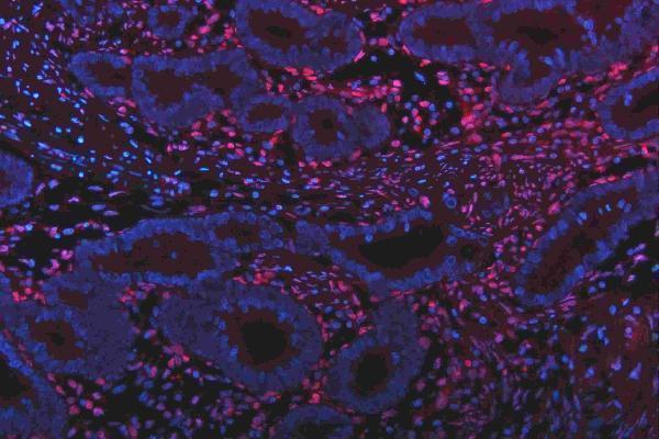 m01874 qk1 primary antibodies if testing 23