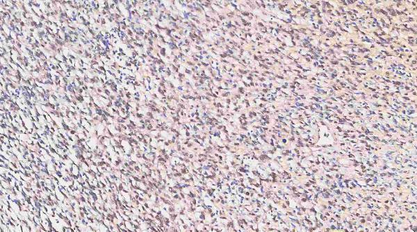 m01874 qk1 primary antibodies ihc testing 12