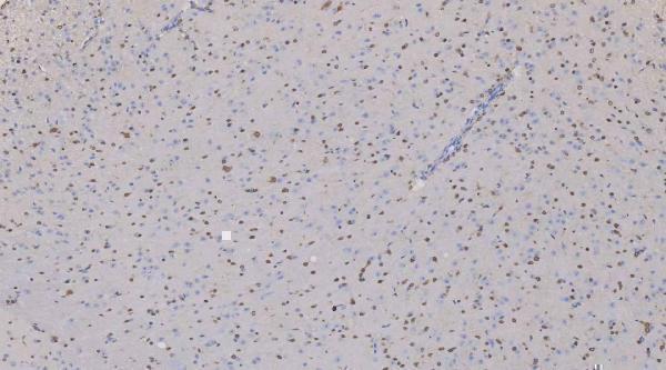 m01874 qk1 primary antibodies ihc testing 13