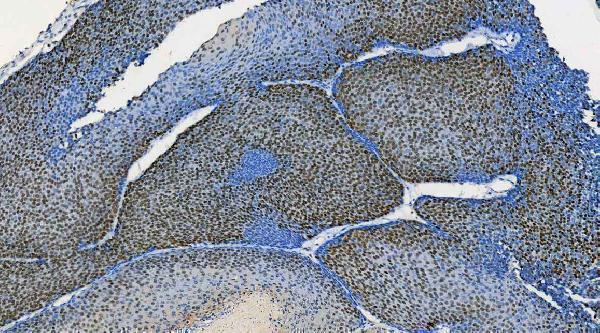 m01874 qk1 primary antibodies ihc testing 14